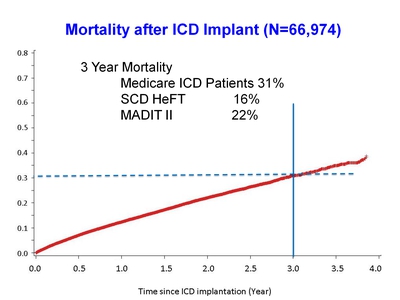 Mortality after ICD Implant (N=66,974)