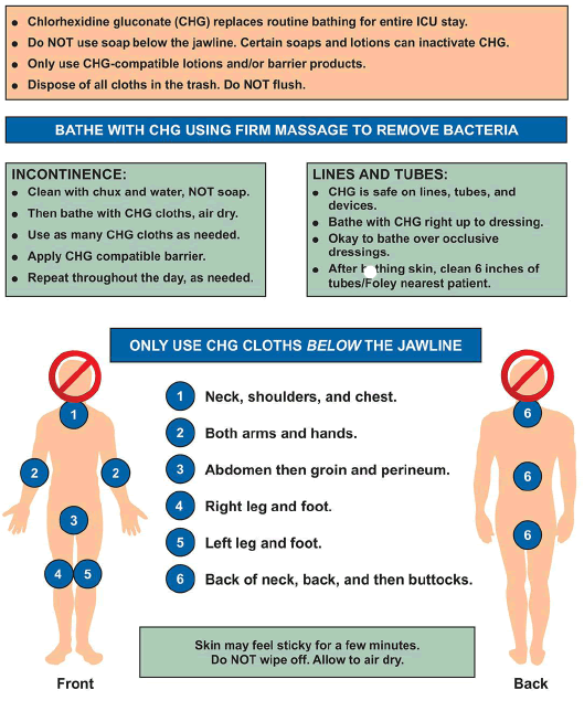 Poster for Universal ICU Decolonization Protocol for CHG Bathing. Drawings depict the front and back of a person, with numbers that correspond to use of chlorhexidine gluconate (CHG) cloths below the jawline only. Text is below the image.