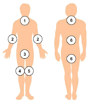 Drawings depict the front and back of a person with numbers to indicate use of six chlorhexidine gluconate (CHG) cloths to bathe the body.