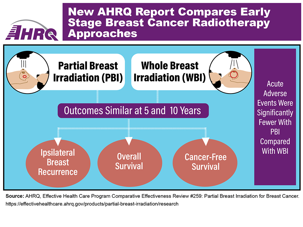 Infographic showing outcomes for partial breast irradiation (PBI), illustrated by a drawing of rays targeting part of the breast; and whole breast irradiation (WBI), illustrated by a drawing of rays targeting the whole breast. Outcomes (ipsilateral breast recurrence, overall survival, and cancer-free survival) were similar at 5 and 10 years, but acute adverse events were significantly fewer with PBI compared with WBI.