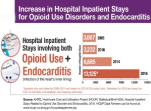 Increase in Hospital Inpatient Stays for Opioid Use Disorders and Endocarditis, 2016
