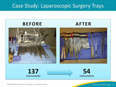 Case Study: Laparoscopic Surgery Trays