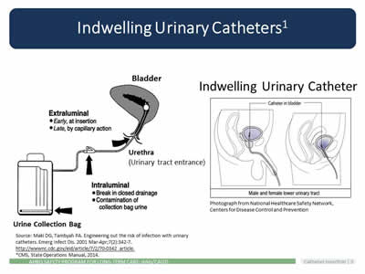 Urinary catheters types